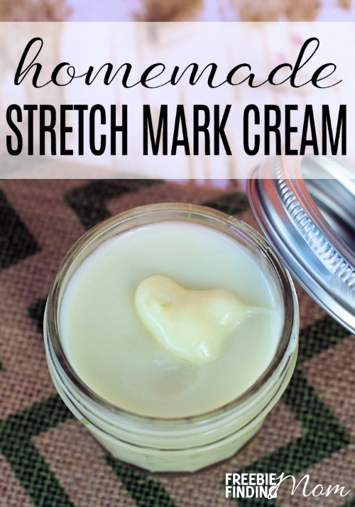 homemade-stretch-mark-cream-pin