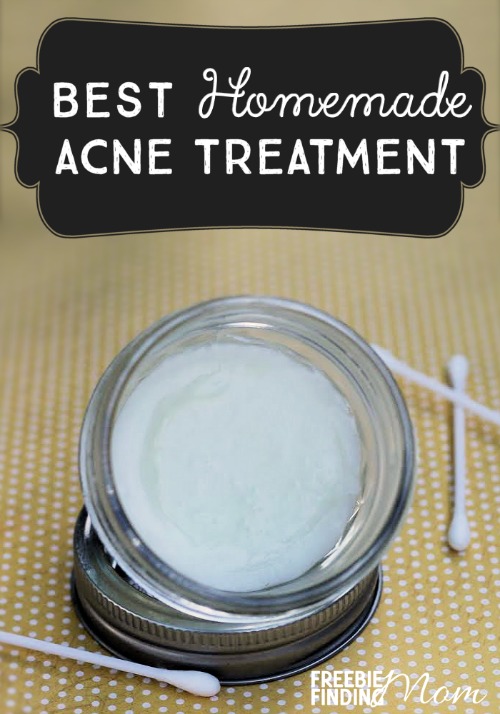 best-homemade-acne-treatment-pin